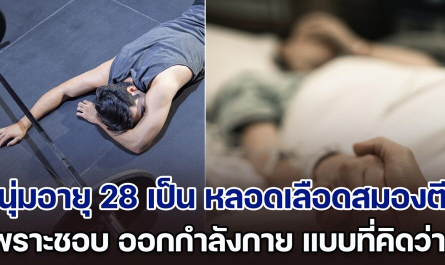 หมอรีบเตือน! หนุ่มอายุแค่ 28 ป่วยเป็น หลอดเลือดสมองตีบ เพราะชอบ ออกกำลังกาย แบบที่คิดว่าดีต่อสุขภาพ