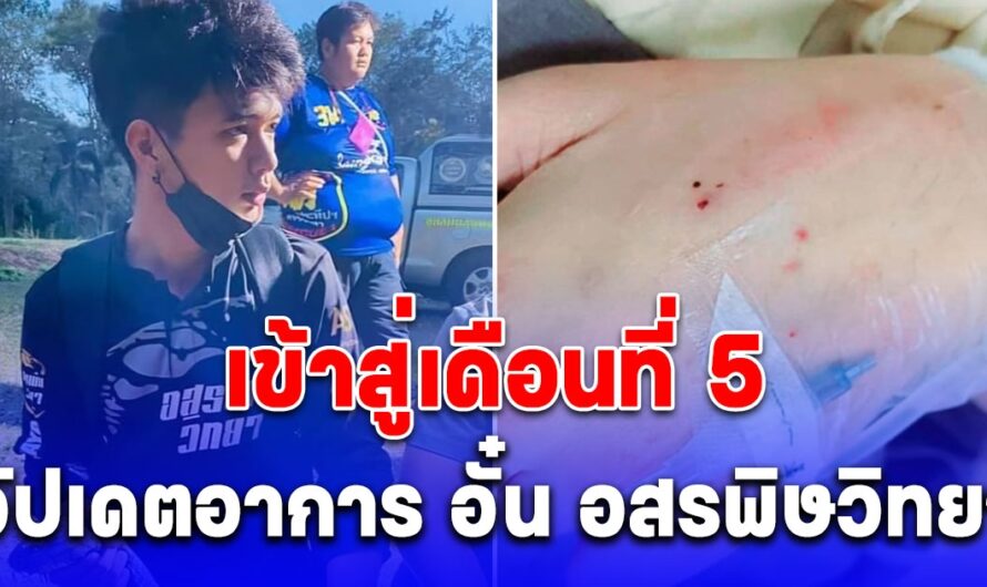 เข้าสู่เดือนที่ 5 อัปเดตอาการ อั๋น อสรพิษวิทยา หลังถูกงูจงอางกัด