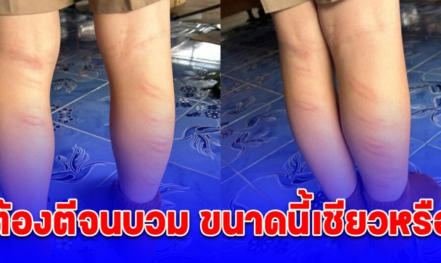 ด.ช.โดนลงโทษด้วยการตี 25 ครั้ง สาเหตุเพราะไม่มีอุปกรณ์การเรียน